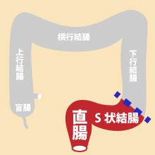 ■S状結腸内視鏡検査